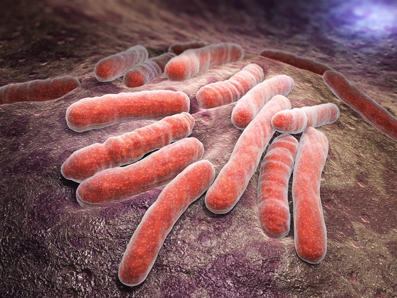 What is Drug-Resistant Tuberculosis and How is it Managed?